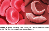 Biology Textbook Chapter Almost Forgets To Mention Sickle Cell Anemia